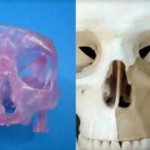Approvato il primo innesto osseo maxillo facciale stampato 3D